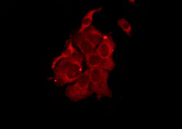 TAS2R14 / TRB1 Antibody - Staining MCF-7 cells by IF/ICC. The samples were fixed with PFA and permeabilized in 0.1% Triton X-100, then blocked in 10% serum for 45 min at 25°C. The primary antibody was diluted at 1:200 and incubated with the sample for 1 hour at 37°C. An Alexa Fluor 594 conjugated goat anti-rabbit IgG (H+L) Ab, diluted at 1/600, was used as the secondary antibody.
