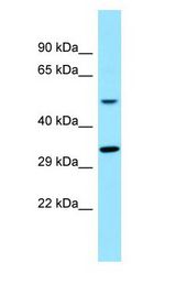 TAS2R16 / T2R16 Antibody - TAS2R16 / T2R16 antibody Western Blot of Placenta.  This image was taken for the unconjugated form of this product. Other forms have not been tested.