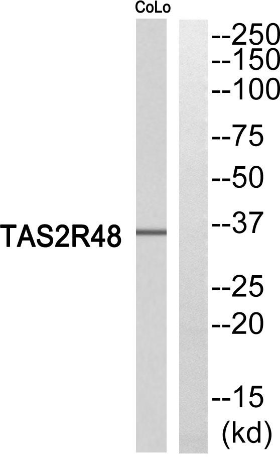 TAS2R19 Antibody - Western blot analysis of extracts from COLO205 cells, using TAS2R48 antibody.