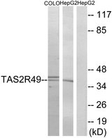 TAS2R20 / TAS2R49 Antibody - Western blot analysis of lysates from COLO and HepG2 cells, using TAS2R49 Antibody. The lane on the right is blocked with the synthesized peptide.