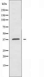 TAS2R20 / TAS2R49 Antibody - Western blot analysis of extracts of COLO cells using TAS2R49 antibody.