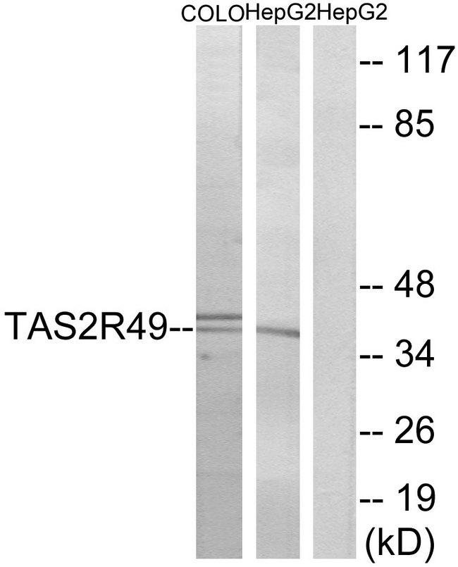 TAS2R20 / TAS2R49 Antibody - Western blot analysis of extracts from COLO cells and HepG2 cells, using TAS2R49 antibody.