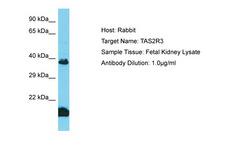 TAS2R3 Antibody -  This image was taken for the unconjugated form of this product. Other forms have not been tested.