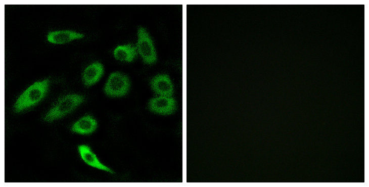 TAS2R3 Antibody - Immunofluorescence analysis of A549 cells, using TAS2R3 Antibody. The picture on the right is blocked with the synthesized peptide.