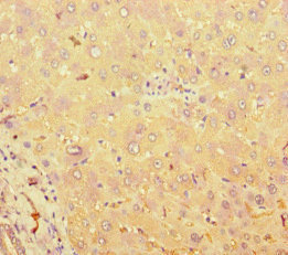 TAS2R38 Antibody - Immunohistochemistry of paraffin-embedded human liver tissue at dilution of 1:100