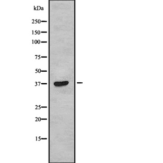 TAS2R38 Antibody - Western blot analysis of TAS2R38 using COLO205 whole cells lysates
