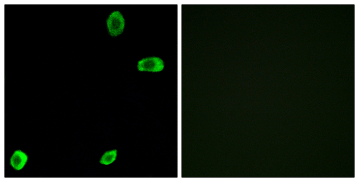 TAS2R39 Antibody - Immunofluorescence analysis of A549 cells, using TAS2R39 Antibody. The picture on the right is blocked with the synthesized peptide.