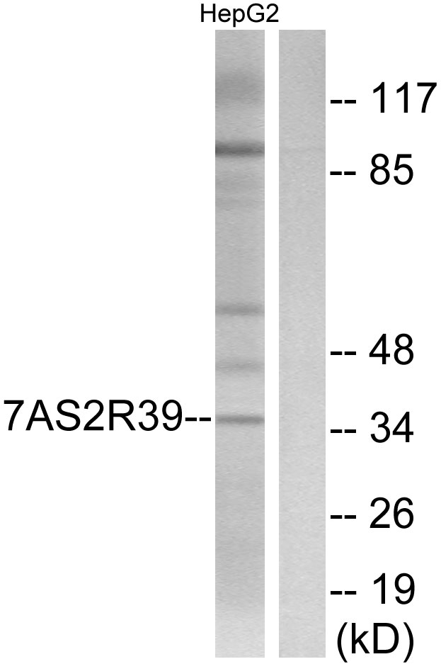 TAS2R39 Antibody - Western blot analysis of lysates from HepG2 cells, using TAS2R39 Antibody. The lane on the right is blocked with the synthesized peptide.