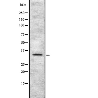 TAS2R4 / T2R4 Antibody - Western blot analysis of TAS2R4 using HT29 whole cells lysates