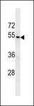 TAS2R43 Antibody - TAS2R43 Antibody western blot of T47D cell line lysates (35 ug/lane). The TAS2R43 antibody detected the TAS2R43 protein (arrow).