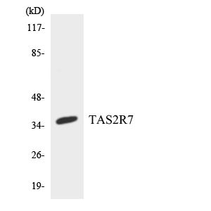 TAS2R7 / T2R7 Antibody - Western blot analysis of the lysates from HepG2 cells using TAS2R7 antibody.