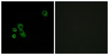 TAS2R7 / T2R7 Antibody - Immunofluorescence analysis of MCF7 cells, using TAS2R7 Antibody. The picture on the right is blocked with the synthesized peptide.