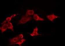 TAS2R7 / T2R7 Antibody - Staining HeLa cells by IF/ICC. The samples were fixed with PFA and permeabilized in 0.1% Triton X-100, then blocked in 10% serum for 45 min at 25°C. The primary antibody was diluted at 1:200 and incubated with the sample for 1 hour at 37°C. An Alexa Fluor 594 conjugated goat anti-rabbit IgG (H+L) Ab, diluted at 1/600, was used as the secondary antibody.