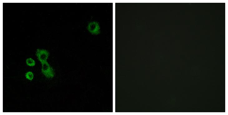 TAS2R7 / T2R7 Antibody - Peptide - + Immunofluorescence analysis of MCF-7 cells, using TAS2R7 antibody.