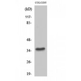 TAS2R8 / T2R8 Antibody - Western blot of T2R8 antibody