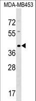 TAS2R9 Antibody - TAS2R9 Antibody western blot of MDA-MB453 cell line lysates (35 ug/lane). The TAS2R9 antibody detected the TAS2R9 protein (arrow).