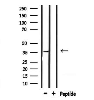 TAS2R9 Antibody - Western blot analysis of extracts of mouse heart tissue using TAS2R9 antibody.