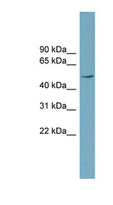 TASP / LANCL2 Antibody - LANCL2 / TASP antibody Western blot of Fetal Muscle lysate. This image was taken for the unconjugated form of this product. Other forms have not been tested.