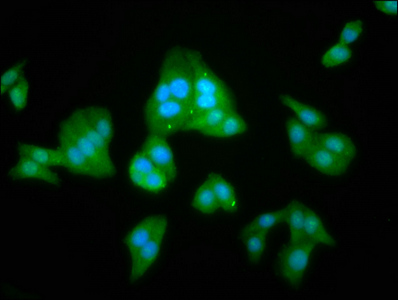 TASP / LANCL2 Antibody - Immunofluorescence staining of HepG2 cells at a dilution of 1:100, counter-stained with DAPI. The cells were fixed in 4% formaldehyde, permeabilized using 0.2% Triton X-100 and blocked in 10% normal Goat Serum. The cells were then incubated with the antibody overnight at 4 °C.The secondary antibody was Alexa Fluor 488-congugated AffiniPure Goat Anti-Rabbit IgG (H+L) .