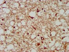 TASP / LANCL2 Antibody - Immunohistochemistry image at a dilution of 1:300 and staining in paraffin-embedded human brain tissue performed on a Leica BondTM system. After dewaxing and hydration, antigen retrieval was mediated by high pressure in a citrate buffer (pH 6.0) . Section was blocked with 10% normal goat serum 30min at RT. Then primary antibody (1% BSA) was incubated at 4 °C overnight. The primary is detected by a biotinylated secondary antibody and visualized using an HRP conjugated SP system.
