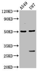 TASP / LANCL2 Antibody - Positive Western Blot detected in A549 whole cell lysate, U87 whole cell lysate. All lanes: LANCL2 antibody at 3.5 µg/ml Secondary Goat polyclonal to rabbit IgG at 1/50000 dilution. Predicted band size: 51 KDa. Observed band size: 51 KDa