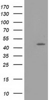 TASP1 Antibody - HEK293T cells were transfected with the pCMV6-ENTRY control (Left lane) or pCMV6-ENTRY TASP1 (Right lane) cDNA for 48 hrs and lysed. Equivalent amounts of cell lysates (5 ug per lane) were separated by SDS-PAGE and immunoblotted with anti-TASP1.