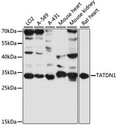 TATDN1 Antibody - Western blot analysis of extracts of various cell lines, using TATDN1 antibody at 1:3000 dilution. The secondary antibody used was an HRP Goat Anti-Rabbit IgG (H+L) at 1:10000 dilution. Lysates were loaded 25ug per lane and 3% nonfat dry milk in TBST was used for blocking. An ECL Kit was used for detection and the exposure time was 1s.