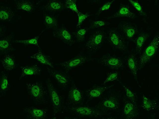 TATDN1 Antibody - Immunofluorescence staining of TATDN1 in HeLa cells. Cells were fixed with 4% PFA, permeabilzed with 0.1% Triton X-100 in PBS, blocked with 10% serum, and incubated with rabbit anti-Human TATDN1 polyclonal antibody (dilution ratio 1:200) at 4°C overnight. Then cells were stained with the Alexa Fluor 488-conjugated Goat Anti-rabbit IgG secondary antibody (green). Positive staining was localized to Nucleus.