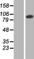 TATDN2 Protein - Western validation with an anti-DDK antibody * L: Control HEK293 lysate R: Over-expression lysate