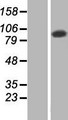 TATDN2 Protein - Western validation with an anti-DDK antibody * L: Control HEK293 lysate R: Over-expression lysate
