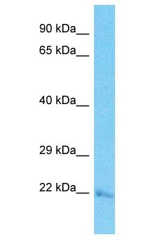 TATDN3 Antibody - TATDN3 antibody Western Blot of ACHN. Antibody dilution: 1 ug/ml.  This image was taken for the unconjugated form of this product. Other forms have not been tested.