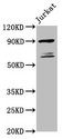 TAX1BP1 Antibody - Positive Western Blot detected in Jurkat whole cell lysate. All lanes: TAX1BP1 antibody at 5.5 µg/ml Secondary Goat polyclonal to rabbit IgG at 1/50000 dilution. Predicted band size: 91, 87, 66, 69 KDa. Observed band size: 91, 69 KDa