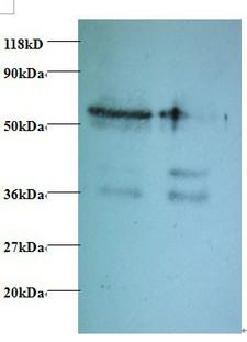 TAX1BP3 Antibody - Western blot of Tax1-binding protein 3 antibody at 2 ug/ml. Lane 1: EC109 whole cell lysate. Lane 2: 293T whole cell lysate. Secondary: Goat polyclonal to Rabbit IgG at 1:15000 dilution. Predicted band size: 13 kDa. Observed band size: 70 kDa Additional bands at: 36 kDa. We are unsure as to the identity of this extra band.  This image was taken for the unconjugated form of this product. Other forms have not been tested.