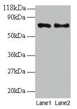 TAX1BP3 Antibody - Western blot All lanes: Tax1-binding protein 3 antibody at 2µg/ml Lane 1: EC109 whole cell lysate Lane 2: 293T whole cell lysate Secondary Goat polyclonal to rabbit IgG at 1/15000 dilution Predicted band size: 13 kDa Observed band size: 70 kDa