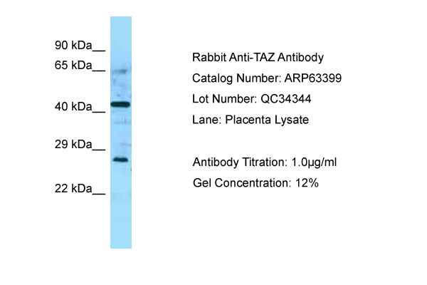 TAZ Antibody -  This image was taken for the unconjugated form of this product. Other forms have not been tested.