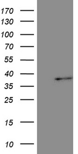 TAZ Antibody - HEK293T cells were transfected with the pCMV6-ENTRY control. (Left lane) or pCMV6-ENTRY TAZ. (Right lane) cDNA for 48 hrs and lysed. Equivalent amounts of cell lysates. (5 ug per lane) were separated by SDS-PAGE and immunoblotted with anti-TAZ. (1:500)
