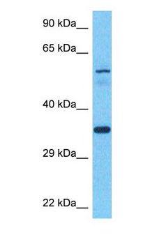 TAZ Antibody - Western blot of TAZ Antibody with human Fetal Lung lysate.  This image was taken for the unconjugated form of this product. Other forms have not been tested.