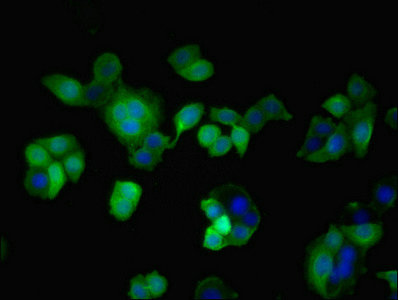 TAZ Antibody - Immunofluorescent analysis of PC-3 cells using TAZ Antibody at dilution of 1:100 and Alexa Fluor 488-congugated AffiniPure Goat Anti-Rabbit IgG(H+L)