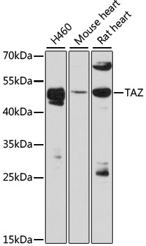 TAZ Antibody - Western blot analysis of extracts of various cell lines, using TAZ antibody at 1:3000 dilution. The secondary antibody used was an HRP Goat Anti-Rabbit IgG (H+L) at 1:10000 dilution. Lysates were loaded 25ug per lane and 3% nonfat dry milk in TBST was used for blocking. An ECL Kit was used for detection and the exposure time was 40s.