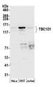 TBC1 / TBC1D1 Antibody - Detection of human TBC1D1 by western blot. Samples: Whole cell lysate (50 µg) from HeLa, HEK293T, and Jurkat cells prepared using NETN lysis buffer. Antibody: Affinity purified rabbit anti-TBC1D1 antibody used for WB at 1 µg/ml. Detection: Chemiluminescence with an exposure time of 30 seconds.