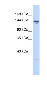 TBC1 / TBC1D1 Antibody - TBC1D1 antibody Western blot of 721_B cell lysate. This image was taken for the unconjugated form of this product. Other forms have not been tested.