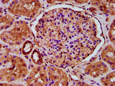 TBC1 / TBC1D1 Antibody - Immunohistochemistry Dilution at 1:500 and staining in paraffin-embedded human kidney tissue performed on a Leica BondTM system. After dewaxing and hydration, antigen retrieval was mediated by high pressure in a citrate buffer (pH 6.0). Section was blocked with 10% normal Goat serum 30min at RT. Then primary antibody (1% BSA) was incubated at 4°C overnight. The primary is detected by a biotinylated Secondary antibody and visualized using an HRP conjugated SP system.