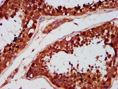 TBC1 / TBC1D1 Antibody - Immunohistochemistry Dilution at 1:500 and staining in paraffin-embedded human testis tissue performed on a Leica BondTM system. After dewaxing and hydration, antigen retrieval was mediated by high pressure in a citrate buffer (pH 6.0). Section was blocked with 10% normal Goat serum 30min at RT. Then primary antibody (1% BSA) was incubated at 4°C overnight. The primary is detected by a biotinylated Secondary antibody and visualized using an HRP conjugated SP system.