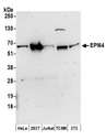 TBC1D10A Antibody - Detection of human and mouse EPI64 by western blot. Samples: Whole cell lysate (50 µg) from HeLa, HEK293T, Jurkat, mouse TCMK-1, and mouse NIH 3T3 cells prepared using NETN lysis buffer. Antibodies: Affinity purified rabbit anti-EPI64 antibody used for WB at 0.1 µg/ml. Detection: Chemiluminescence with an exposure time of 3 minutes.
