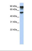 TBC1D10B Antibody - Hela cell lysate. Antibody concentration: 1.0 ug/ml. Gel concentration: 12%.  This image was taken for the unconjugated form of this product. Other forms have not been tested.