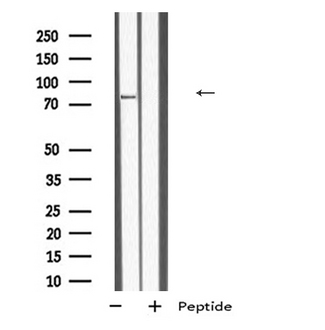 TBC1D10B Antibody - Western blot analysis of TB10B expression in HEK293 cells. The lane on the left is treated with the antigen-specific peptide.