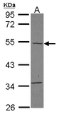 TBC1D10C / CARABIN Antibody - Sample (30 ug of whole cell lysate) A: A431 10% SDS PAGE TBC1D10C antibody diluted at 1:500