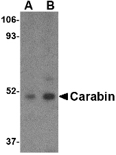TBC1D10C / CARABIN Antibody - Western blot of Carabin in Daudi cell lysate with Carabin antibody at (A) 1 and (B) 2 ug/ml.