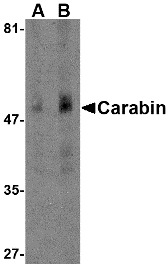 TBC1D10C / CARABIN Antibody - Western blot of Carabin in human spleen tissue lysate with Carabin antibody at (A) 1 and (B) 2 ug/ml.
