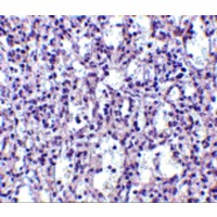 TBC1D10C / CARABIN Antibody - Immunohistochemistry of Carabin in human spleen tissue with Carabin antibody at 2.5 µg/mL.